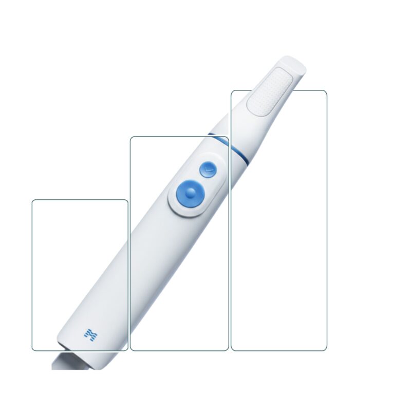 Blog Escaner Intraoral