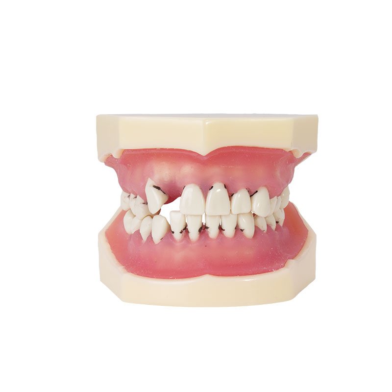 0905109-Tipodonto-periodoncia-2-1.jpg Modelo de periodoncia Bader - Imagen 1