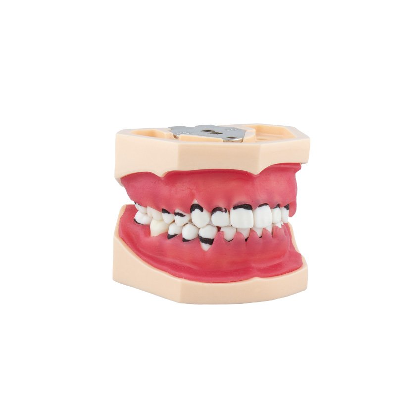 0905113-Modelo-de-periodoncia-completo.jpg Modelo de Periodoncia Completo Bader - Imagen 1