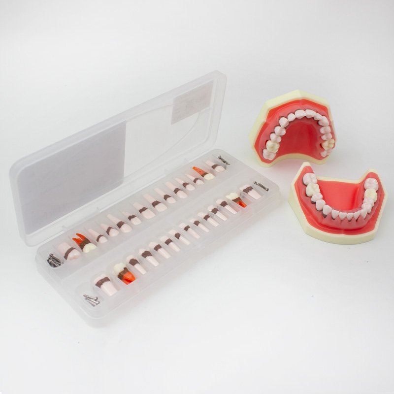 0905125-1-Reposicion-de-dientes-2.jpg Reposición de Dientes para Tipodonto de Periodoncia Bader - Imagen 1