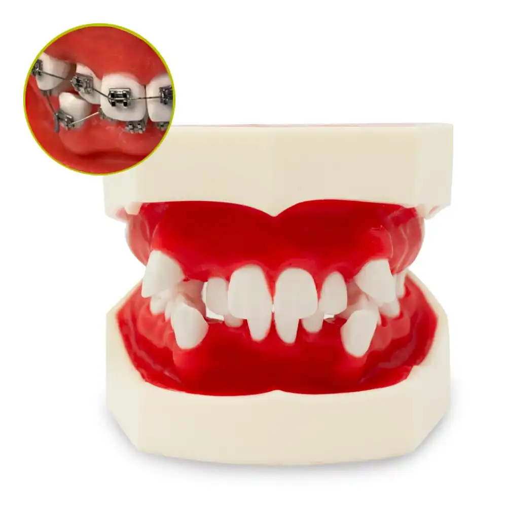 0905137-Tipodonto-para-practicas-de-ortodoncia-cementado-y-biomecanica-con-Brackets-3.webp Tipodonto Ortodoncia Cementada y Biomédica Bader - Imagen 1